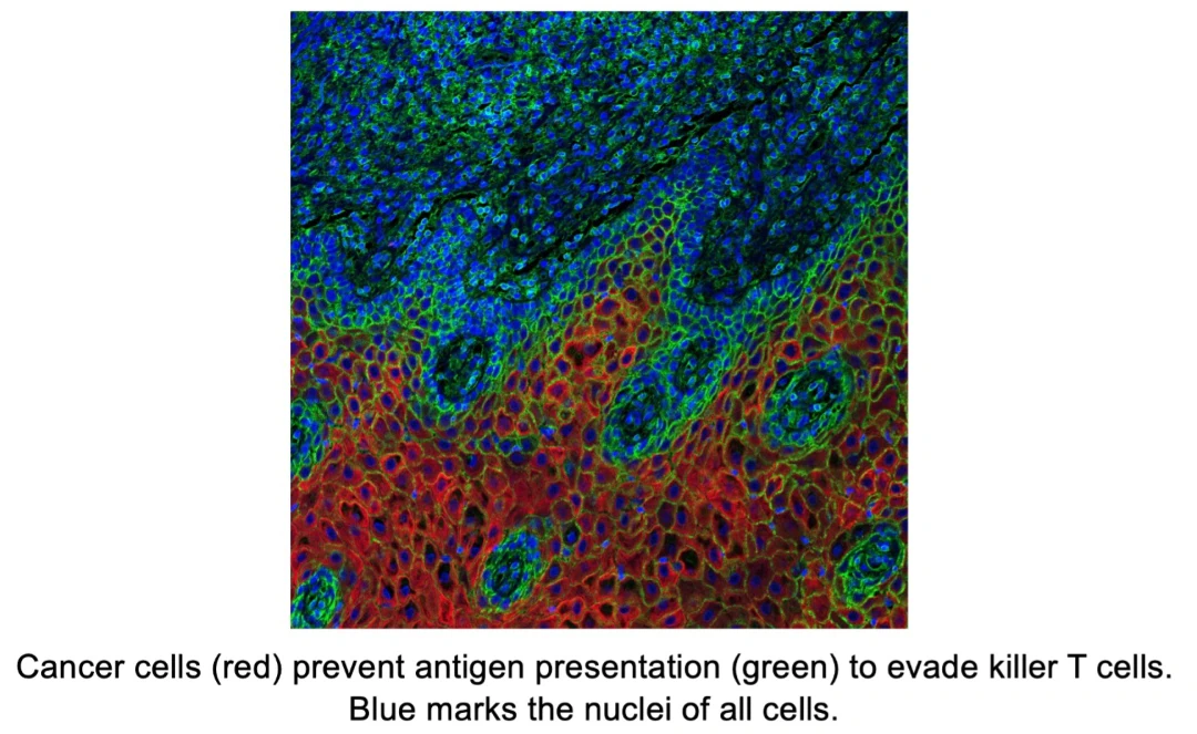 Cancer cells, shown in red, prevent the presentation of antigens, shown in green, and evade T cells, which kill cancer cells as a part of the body’s immune system. Image courtesy of Lexi Vu in the Pyeon lab at Michigan State University.
